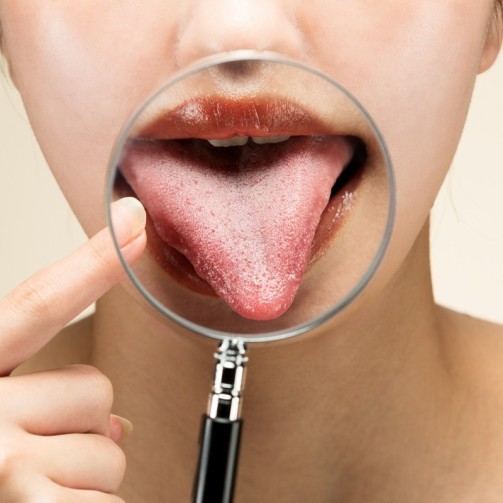 Formation orthophonie - La langue et la sphère oro-faciale